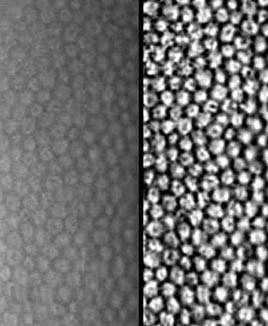 Comptage endothelial